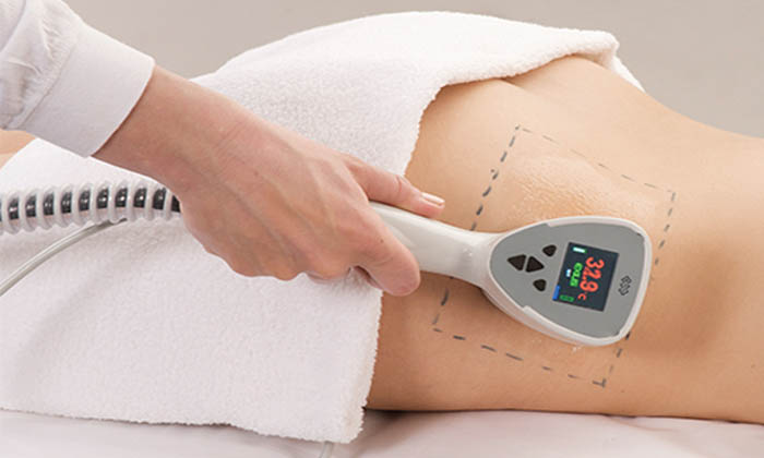 دستگاه لاغری اکسیلیس را بشناسید